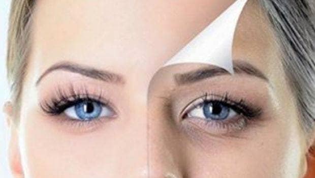  What are the Best Treatments for Dark Eyes Circle Removal