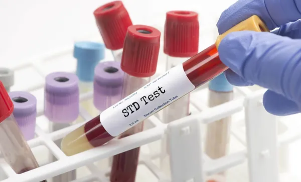  Understanding the Types of STD Tests Available in Singapore