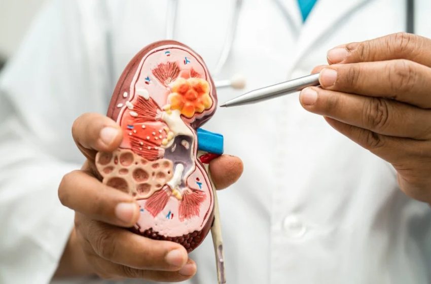  How Texas Kidney Care Treat Hypertension Problem?