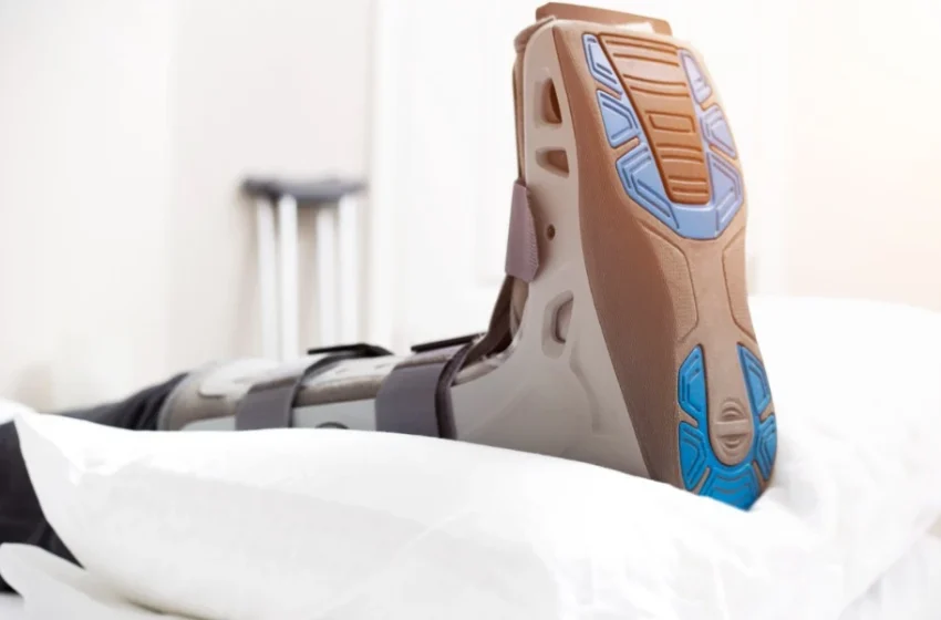  Ankle Binder Uses for Post-Cast Pain Relief