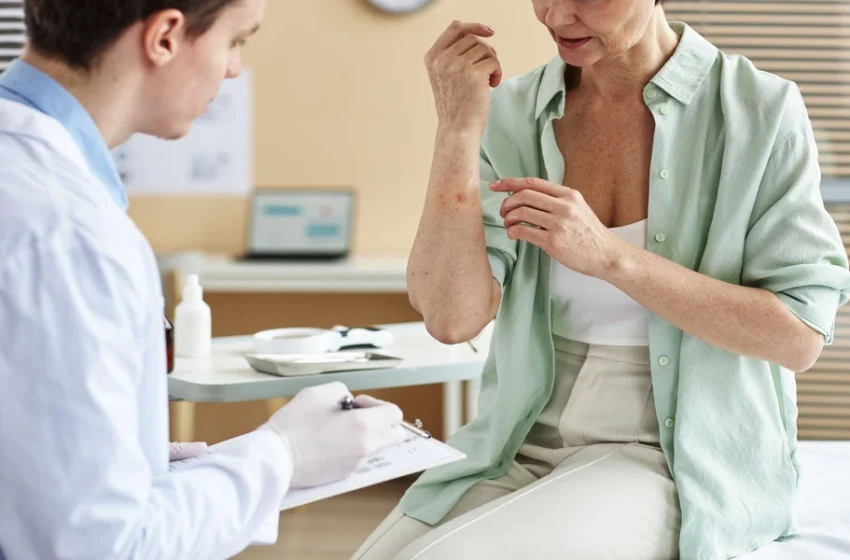  What Is the Difference Between Mild, Moderate and Severe Psoriasis?